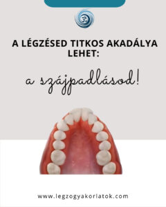 gótikus szájpadlás