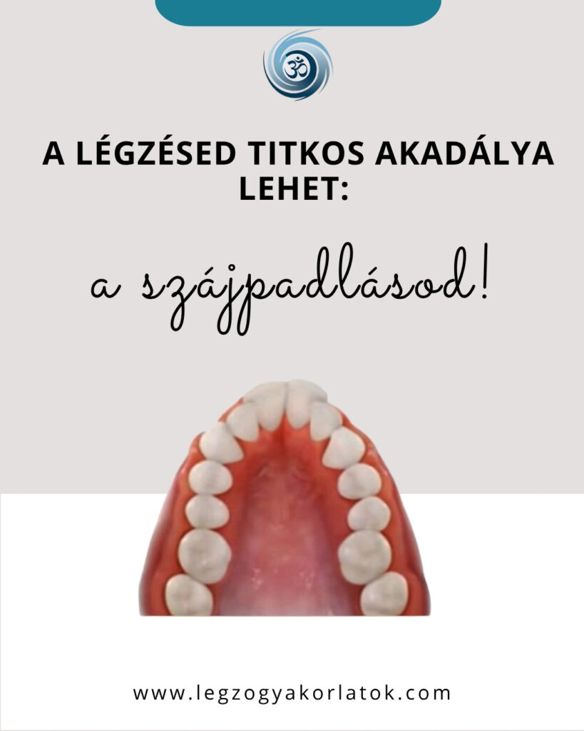 gótikus szájpadlás